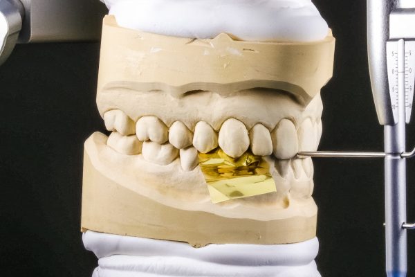 Dentaltechnik Leipzig